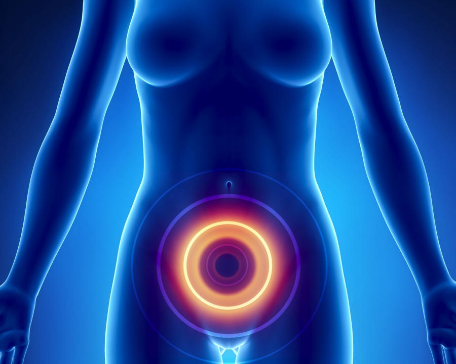11 Nguyên nhân đau lưng và bụng dưới ở phụ nữ